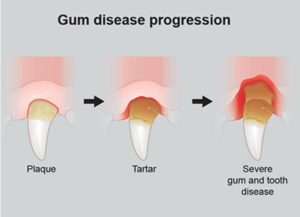 Dental Disease in Dogs